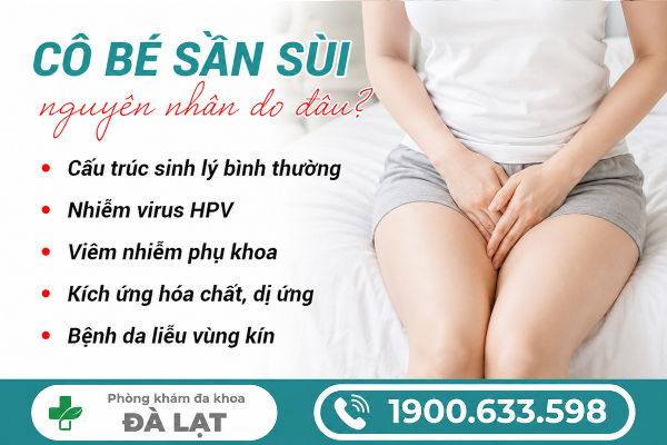 Hình ảnh minh họa
